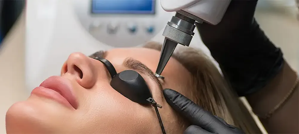 Remoção de Micropigmentação a Laser — Soraia Barros